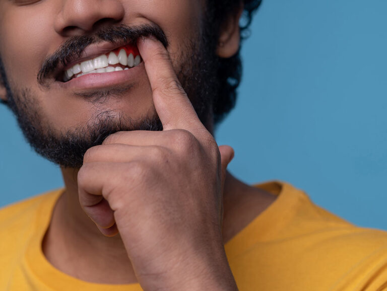 Gum disease