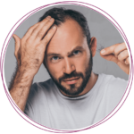 man suffering from hair loss