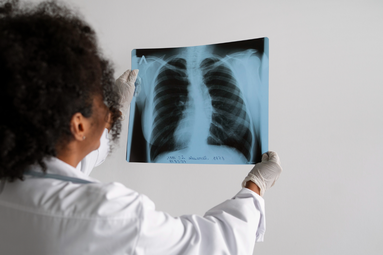 Physician looking at an X-ray scan