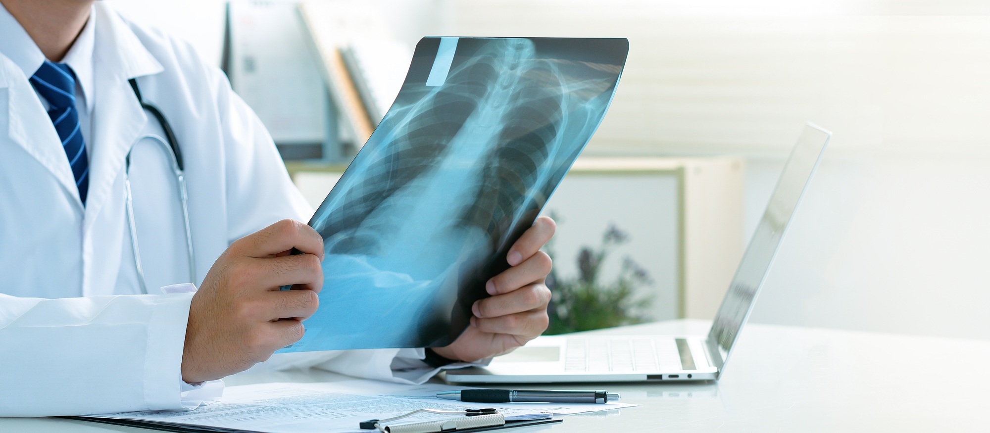 Doctor examining the patient chest x-ray film lungs scan in hospital. Lung problem. Lung Cancer.